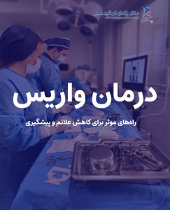 درمان واریس : راه‌های موثر برای کاهش علائم و پیشگیری