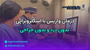 درمان واریس با اسکلروتراپی 1404
