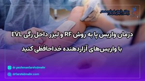 درمان واریس پا به روش RF و لیزر داخل رگی EVL با واریس‌های آزاردهنده خداحافظی کنید [بهترین روش درمان 1404]