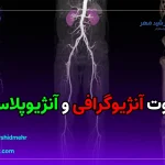 تفاوت آنژیوگرافی و آنژیوپلاستی چیست؟ [دکتر پژمان فرشیدمهر]